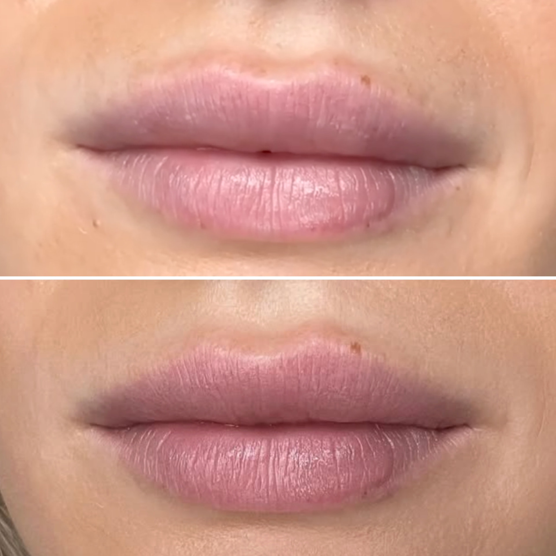Før og efter permanent makeup til læber — case 4