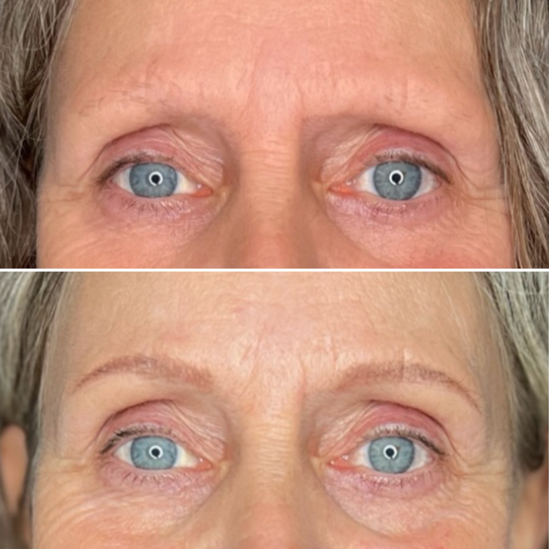 Før og efter permanent makeup til bryn — case 5