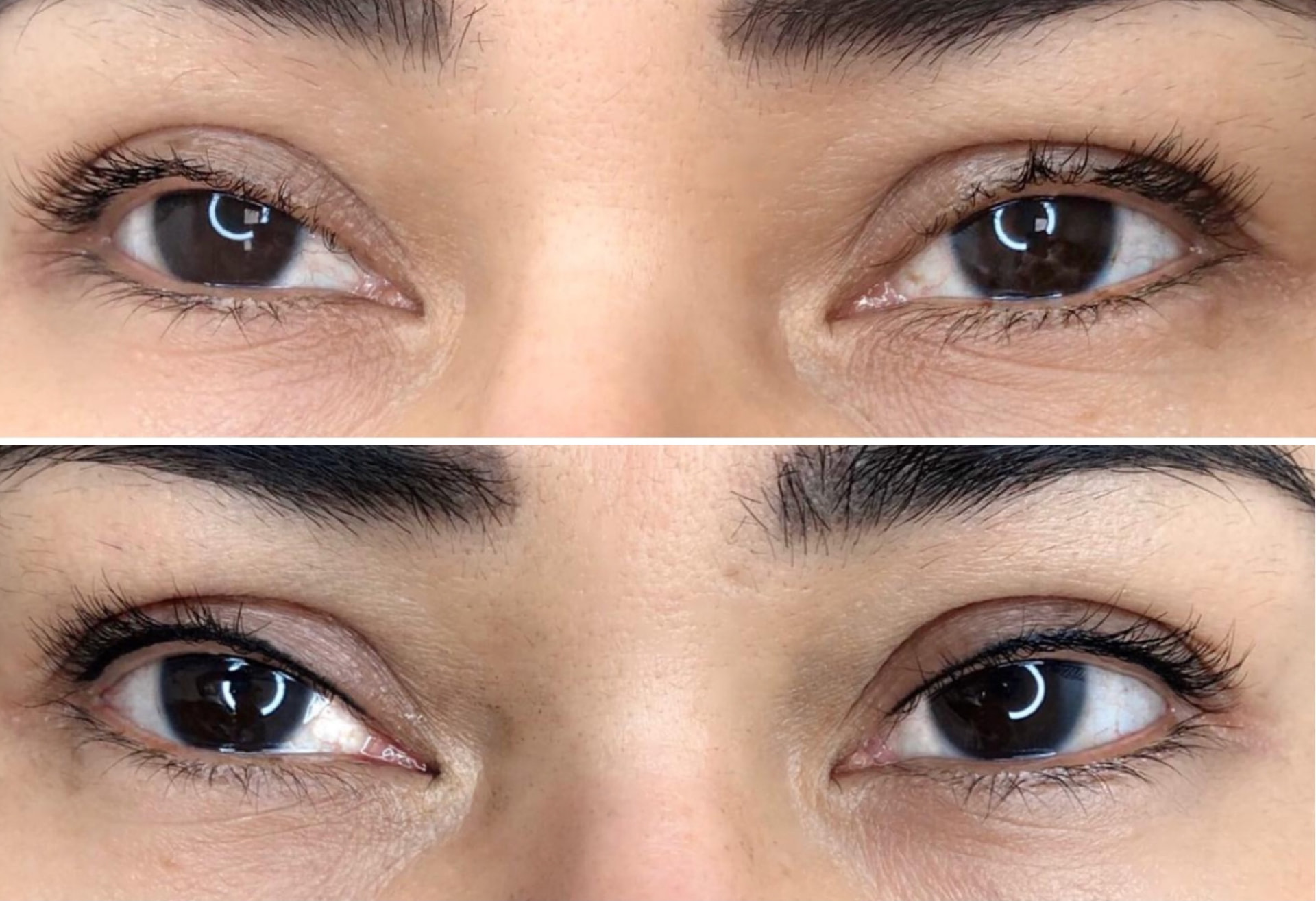 Før og efter eyeliner eller vippefortætning — case 6