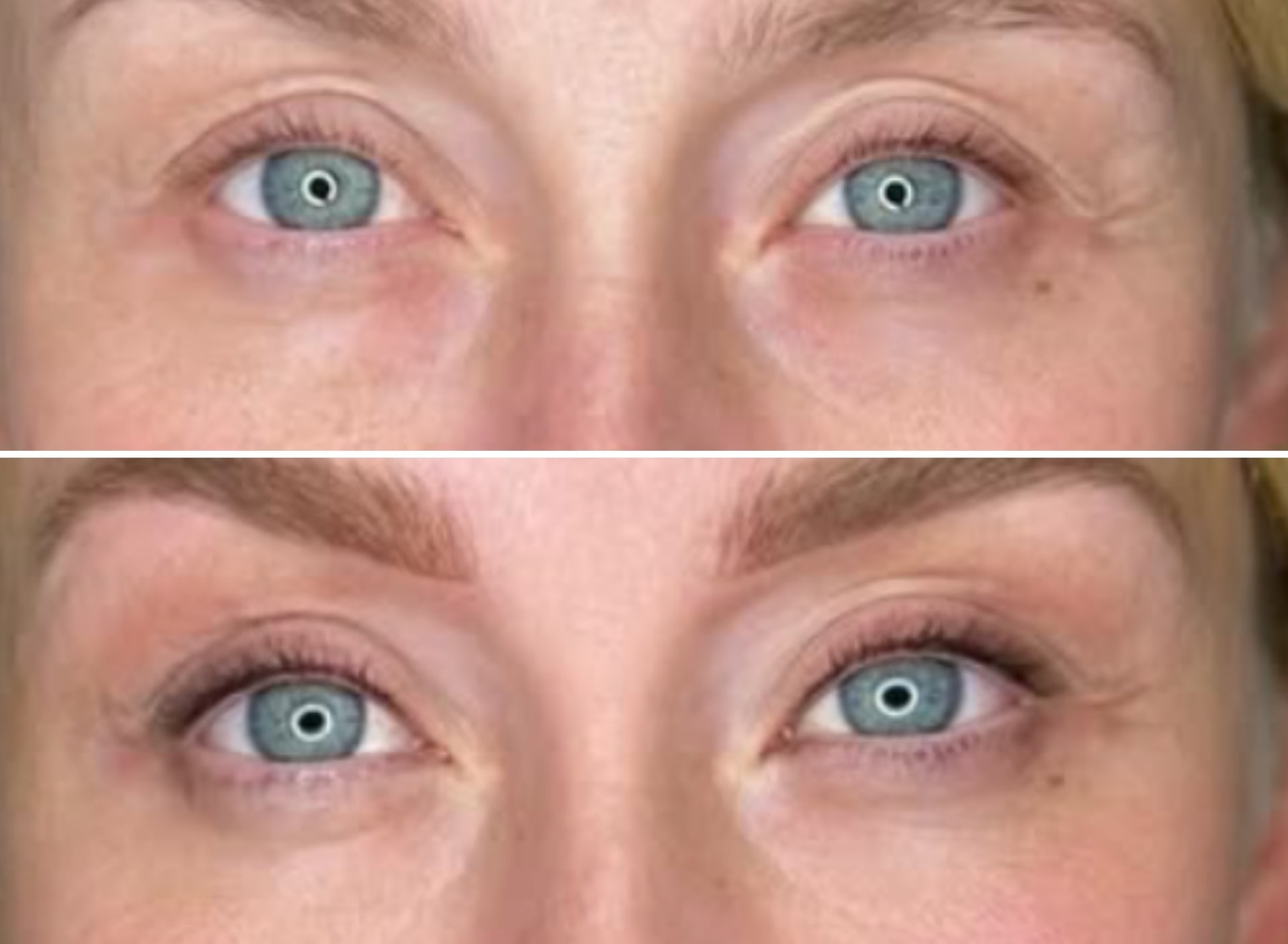 Før og efter eyeliner eller vippefortætning — case 5